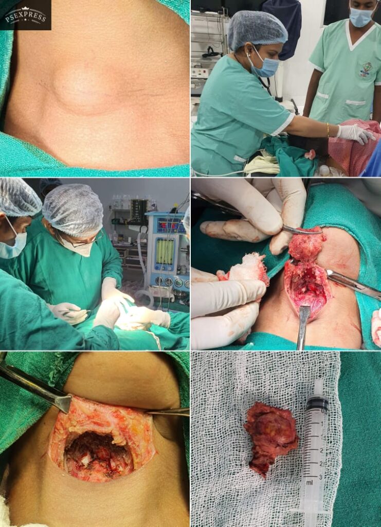 ENT Doctor in Meerut